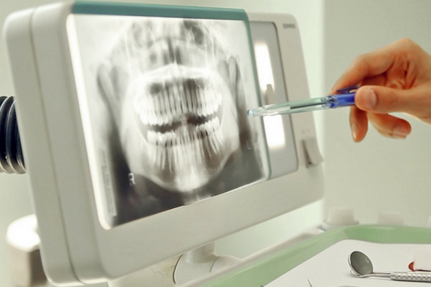 Novidade no sistema: Odontograma